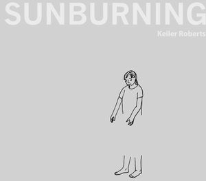 [Sunburning (Product Image)]
